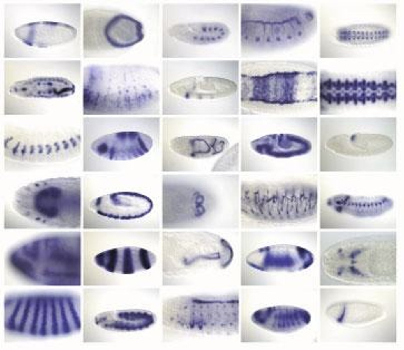 <p>Gene expression is regulated to ensure that specific genes are activated in the appropriate cell types.</p>