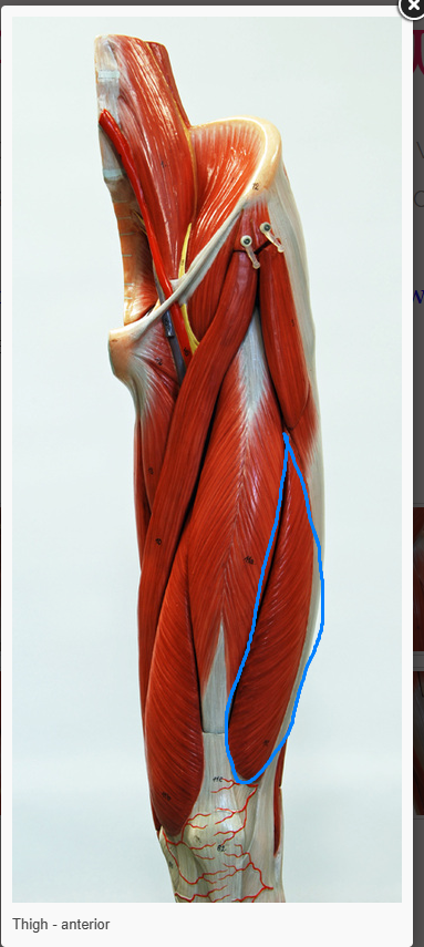 <p>what is the name of the muscle circled </p>