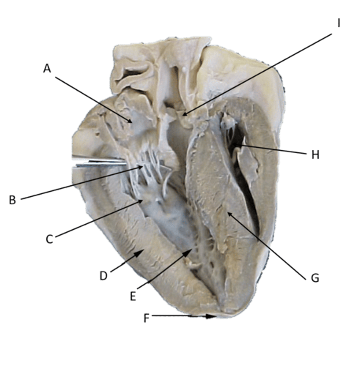 <p>Identify the structure labeled G</p>