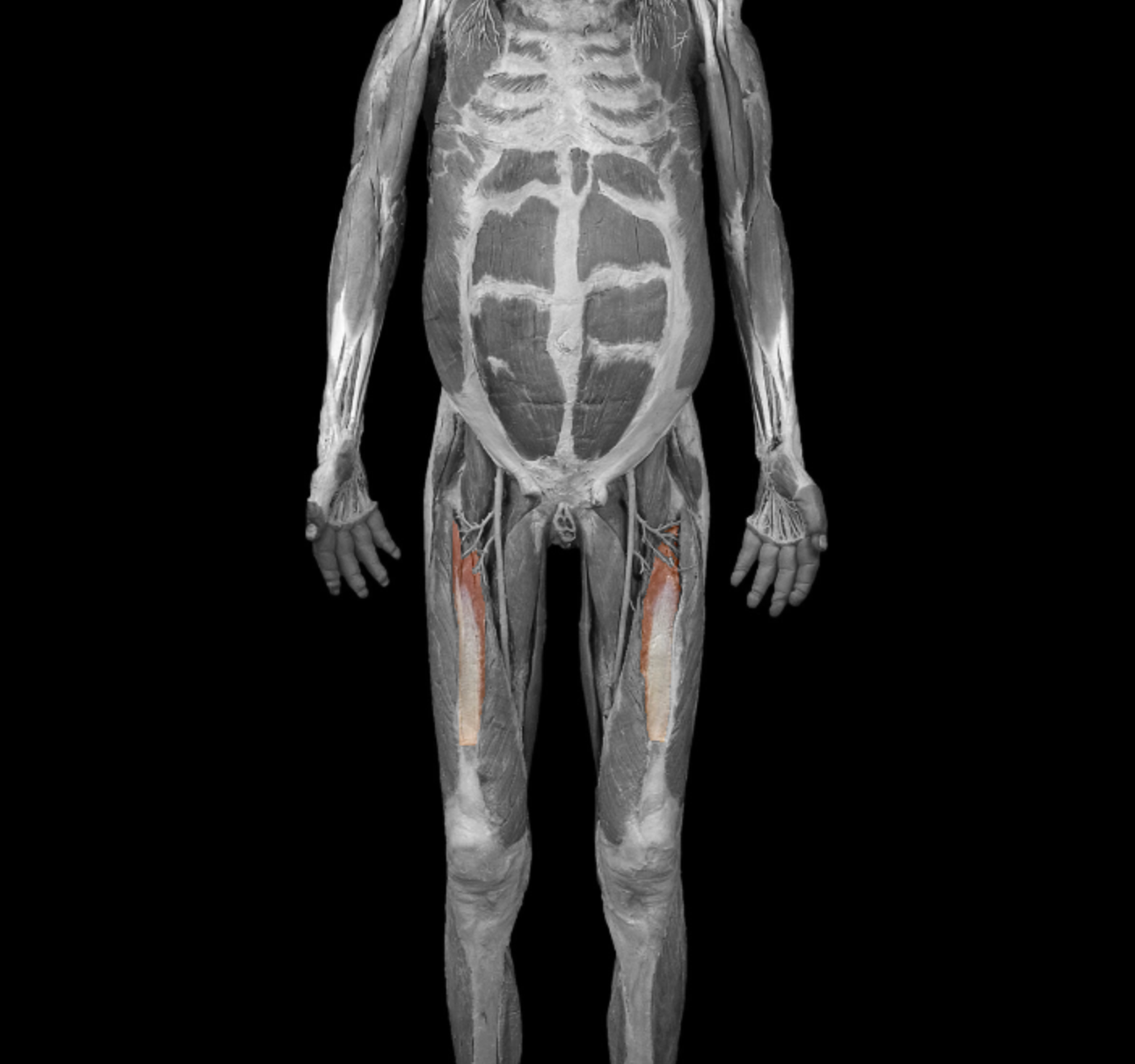 <p>origin: anterior + lateral surface of fetus </p><p></p><p>insertion: patella  via quadriceps tendon (patellar ligament to tibial tuberosity) </p><p></p><p>action: extend leg at. knee </p><p></p><p>innervation: femoral nerve </p>