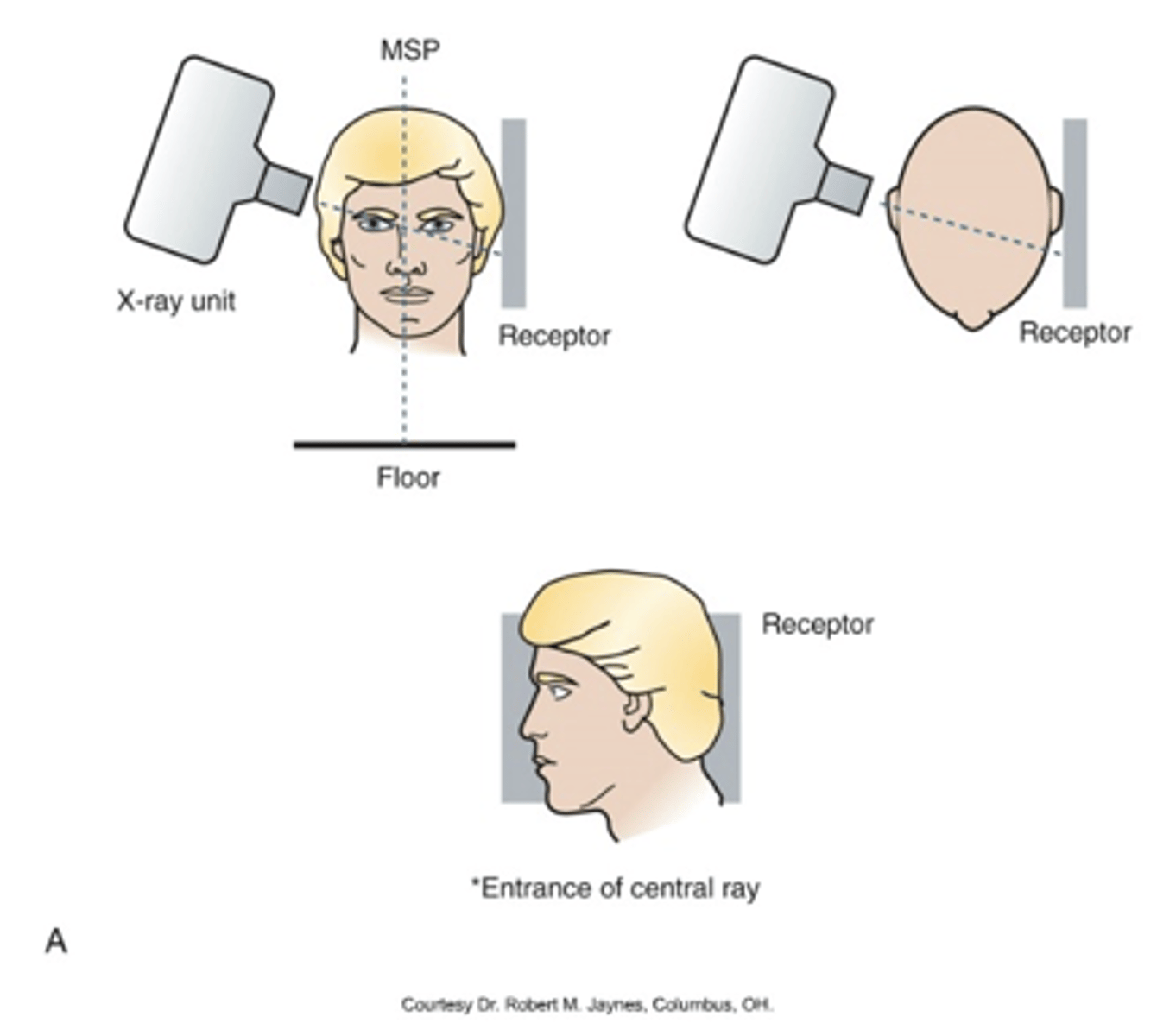 <p>-flat against ear</p><p>- centered over TMJ</p>