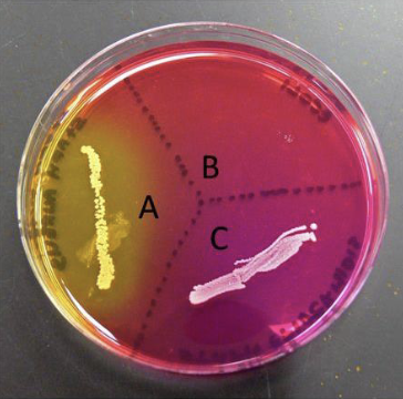 <p>Selective and differential </p><p>A) Positive (mannitol fermentation)</p><p>B) Inhibit growth </p><p>C) Negative </p>