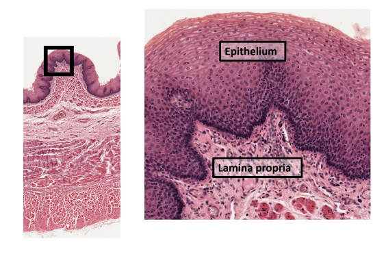 <ul><li><p>epithelium (inner lining)</p><ul><li><p>stratified squamous at beginning and end of tract</p><ul><li><p>mouth, pharynx, esophagus, anal canal</p></li></ul></li></ul></li><li><p>simple columnar in middle</p><ul><li><p>stomach &amp; small and large intestine</p></li></ul></li><li><p>lots of glands</p></li></ul><p></p>