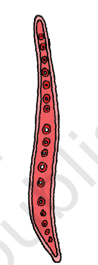 <p>Identify the cells, describe their shape, where are they present?</p>