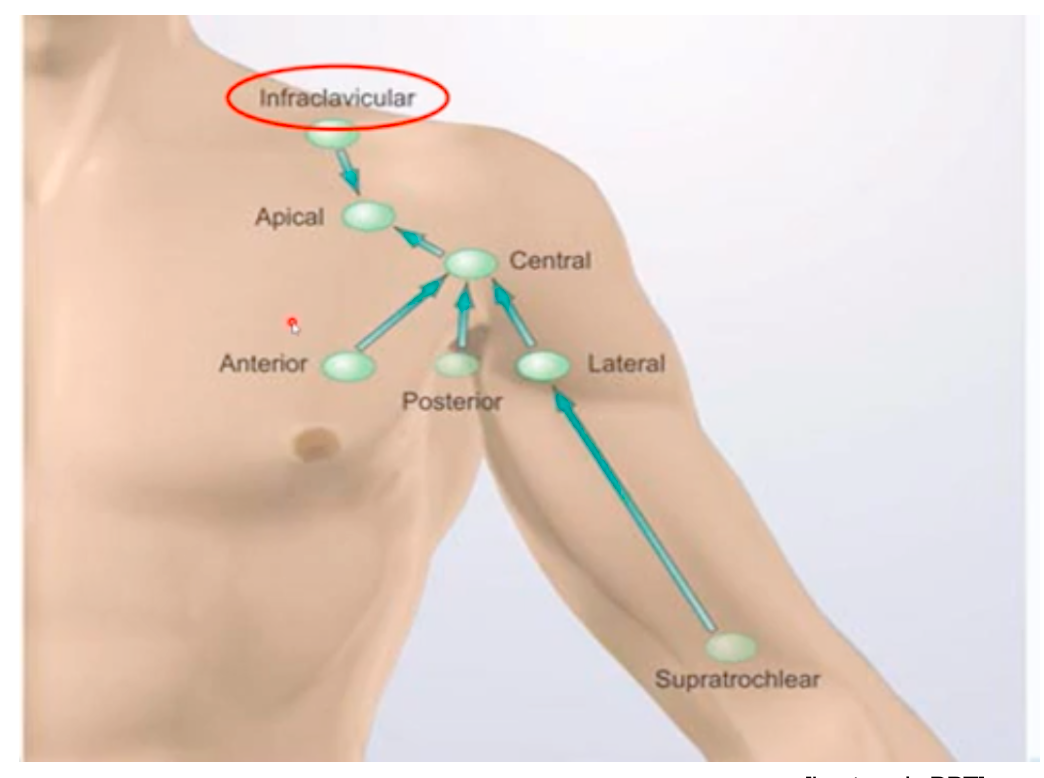 <p>Lateral. Look at the figure. </p>