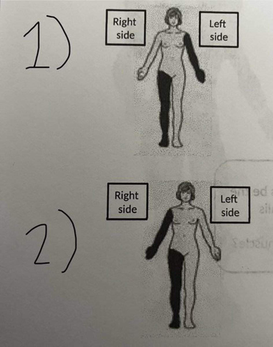 <p>What does #2 represent? (think of the same)</p>