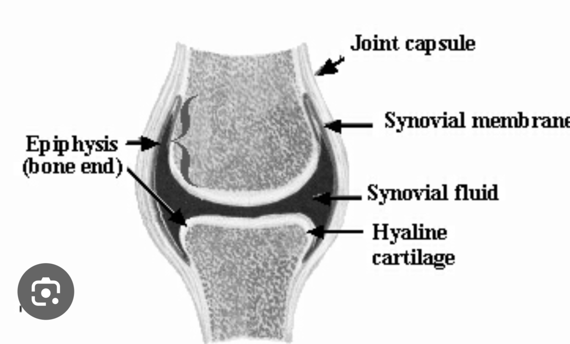 <p>Synovial membrane</p>