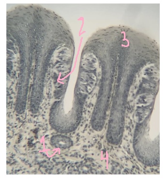 <p>What is #4 pointing to?</p>