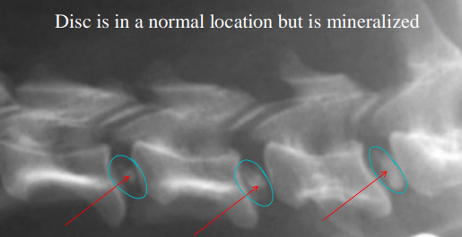 <p>Intervertebral Disc Disease</p>