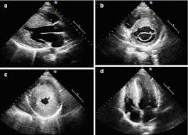 <p>Echocardiogram</p>