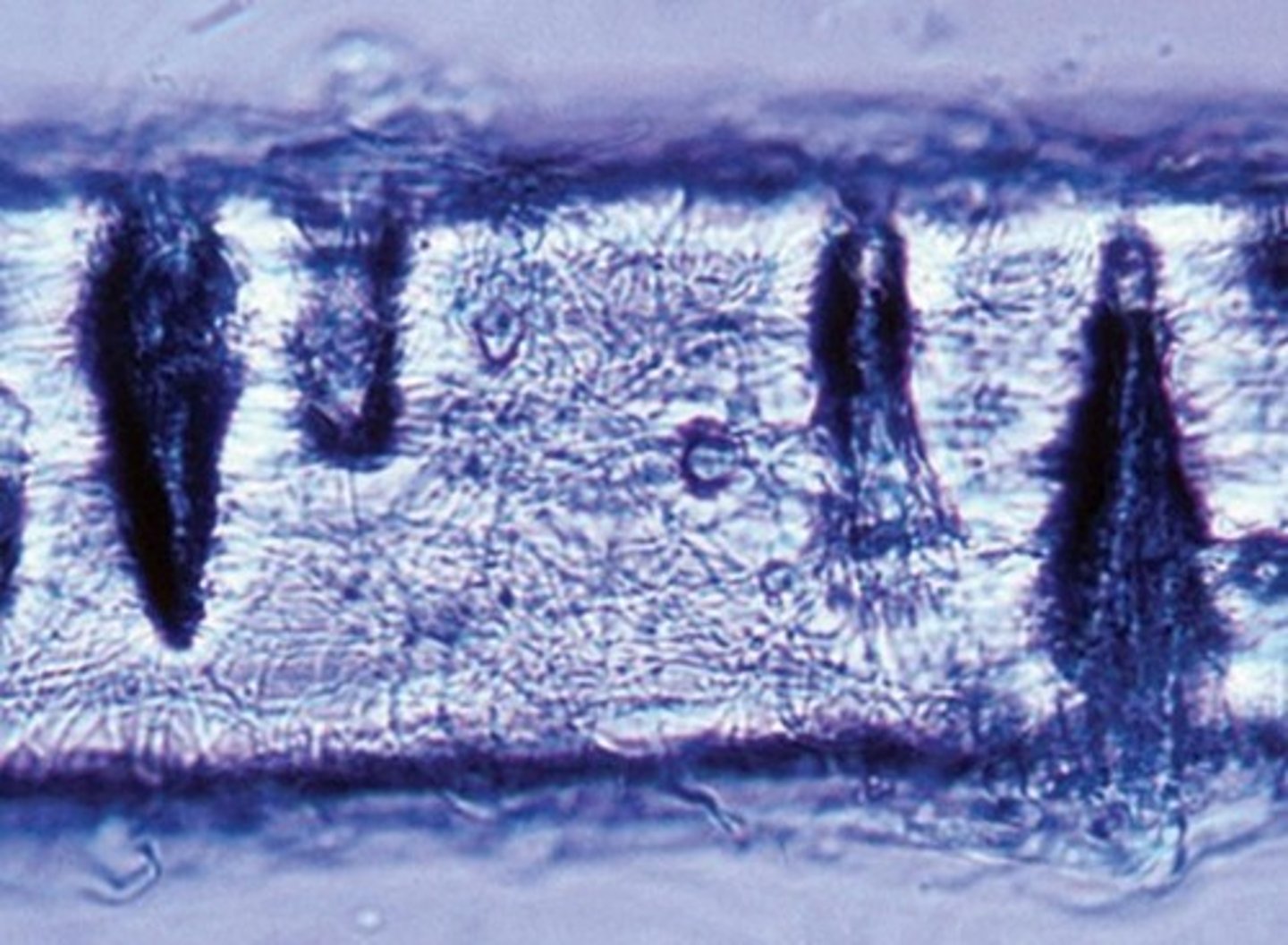 <p>Looks very similar to T.</p><p>rubrum</p><p>• Positive for hair perforation</p>
