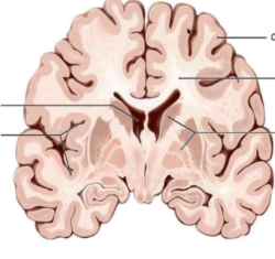 <p>What color is the gray matter and what are they composed of?</p>