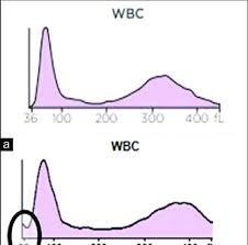 <p>What is the circle indicating</p>