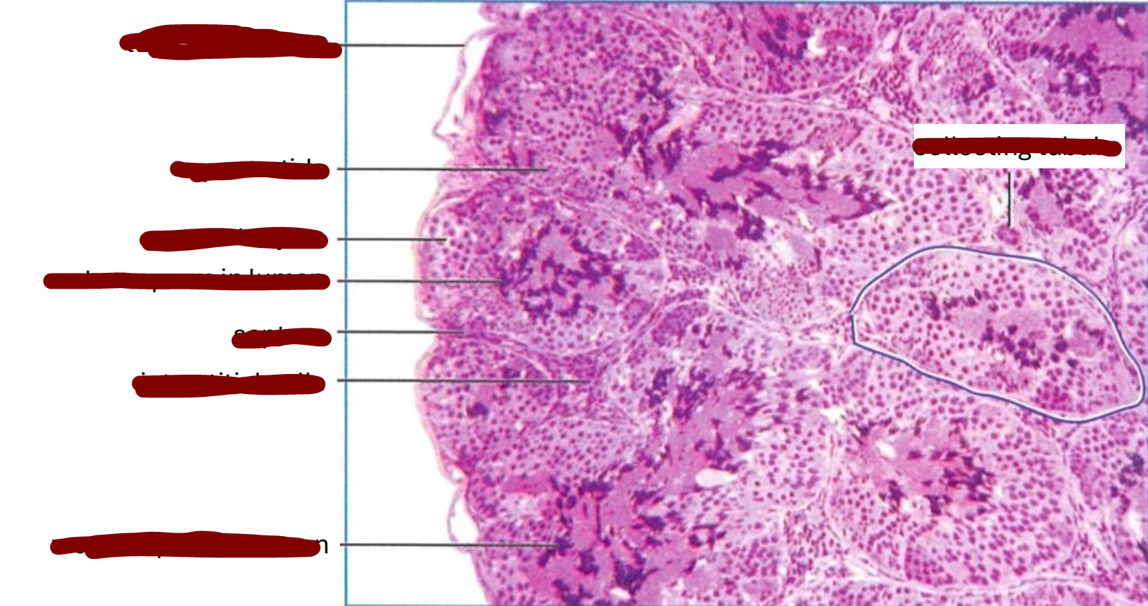 <p>section through part of a frog testis</p>