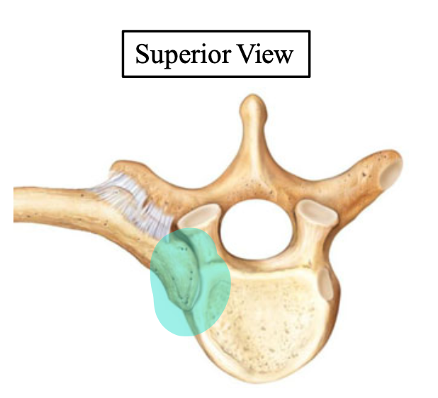 <p>Name the highlighted structure (on the rib)</p>