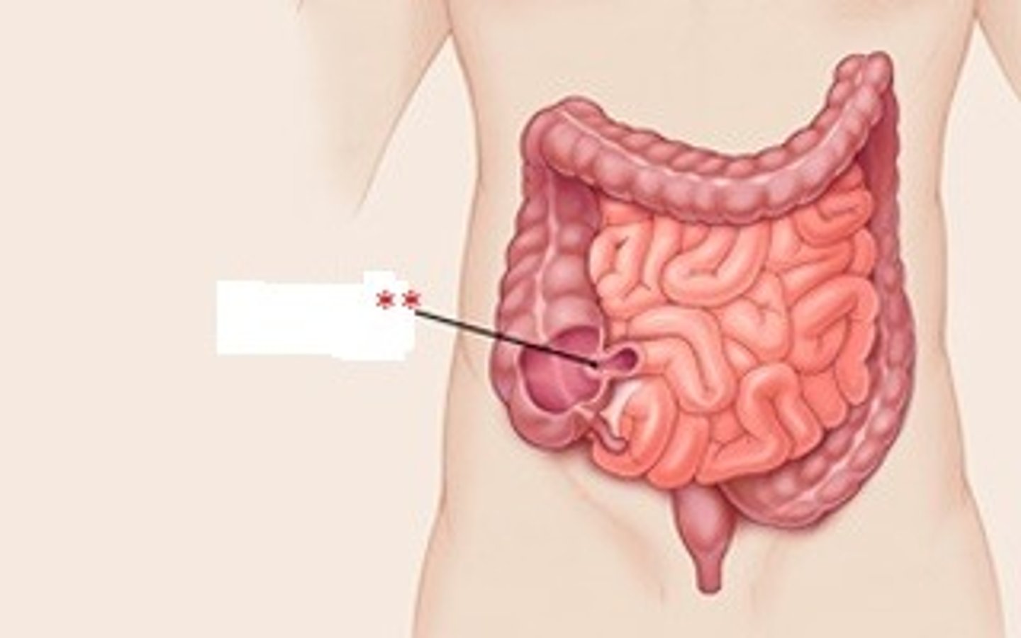 <p>valve between the ileum of the small intestine and the cecum of the large intestine; prevents material from flowing back from the large to the small intestine</p>