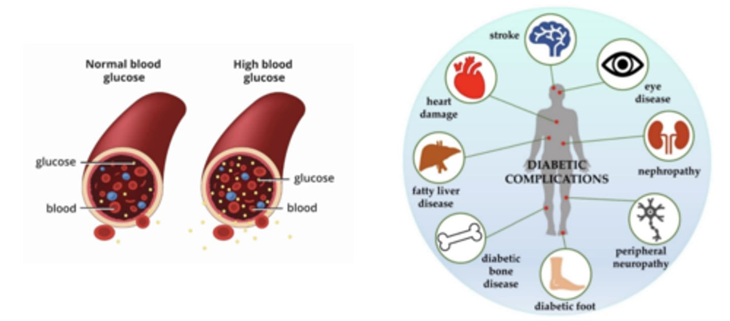 <p>insulin is not secreted adequately or tissues are resistant to its effects</p>
