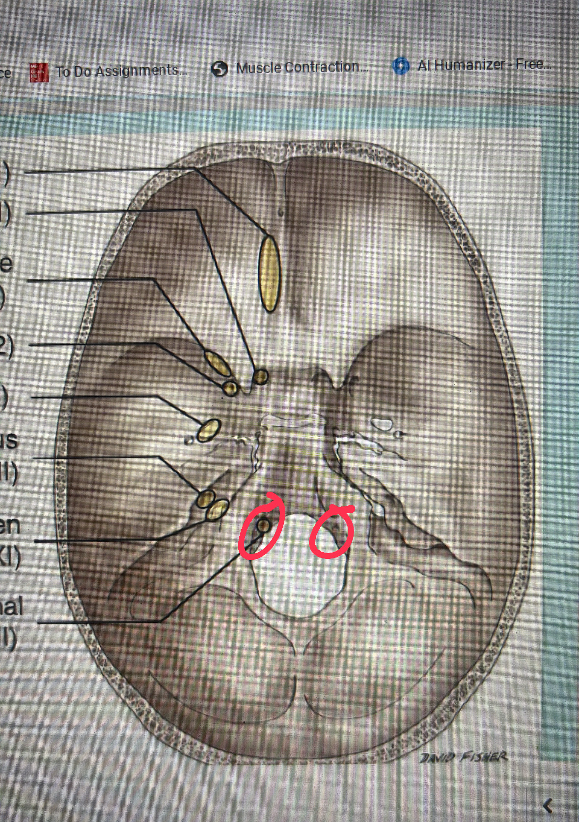 <p>cranial nerve XII</p>