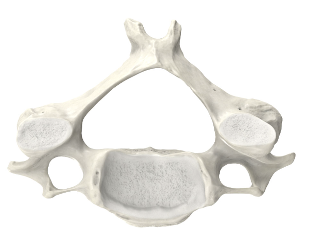 <p>Identify the part of the vertebra and explain what diagnostic features helped you reach your conclusion.</p>