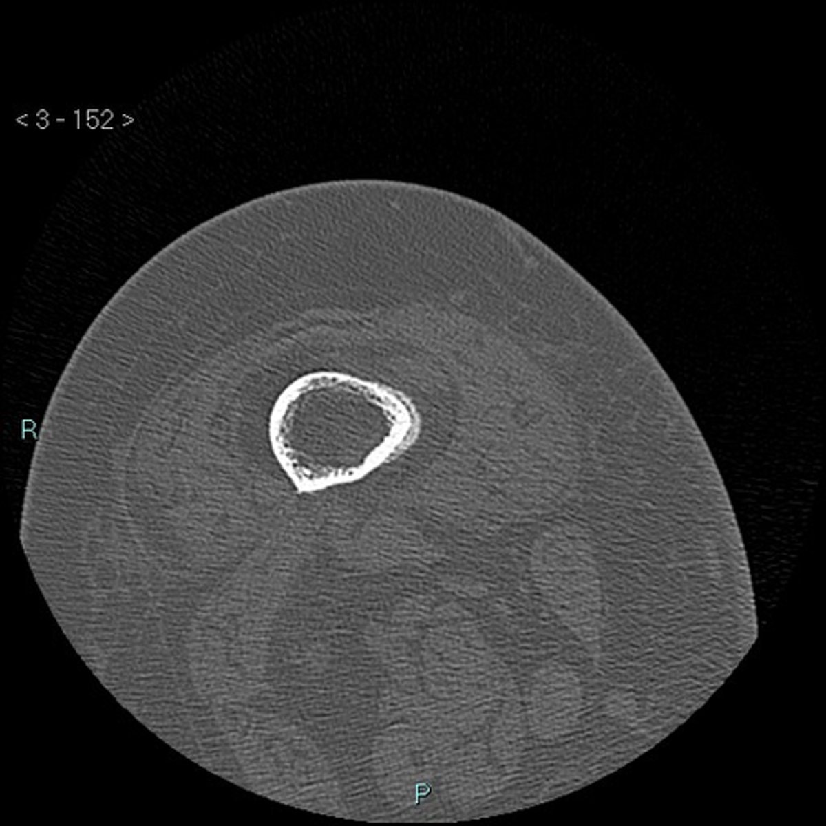<p>Diagnosis?</p>