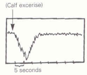 <p>Identify this image. </p>