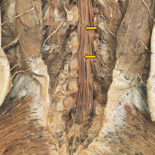 <p>What are the orange arrows pointing at?</p>