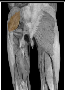 <p>Gluteus medius</p>