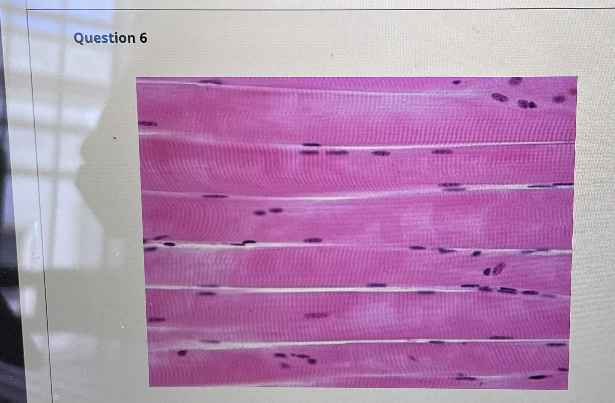 What type of tissue is pictured here 