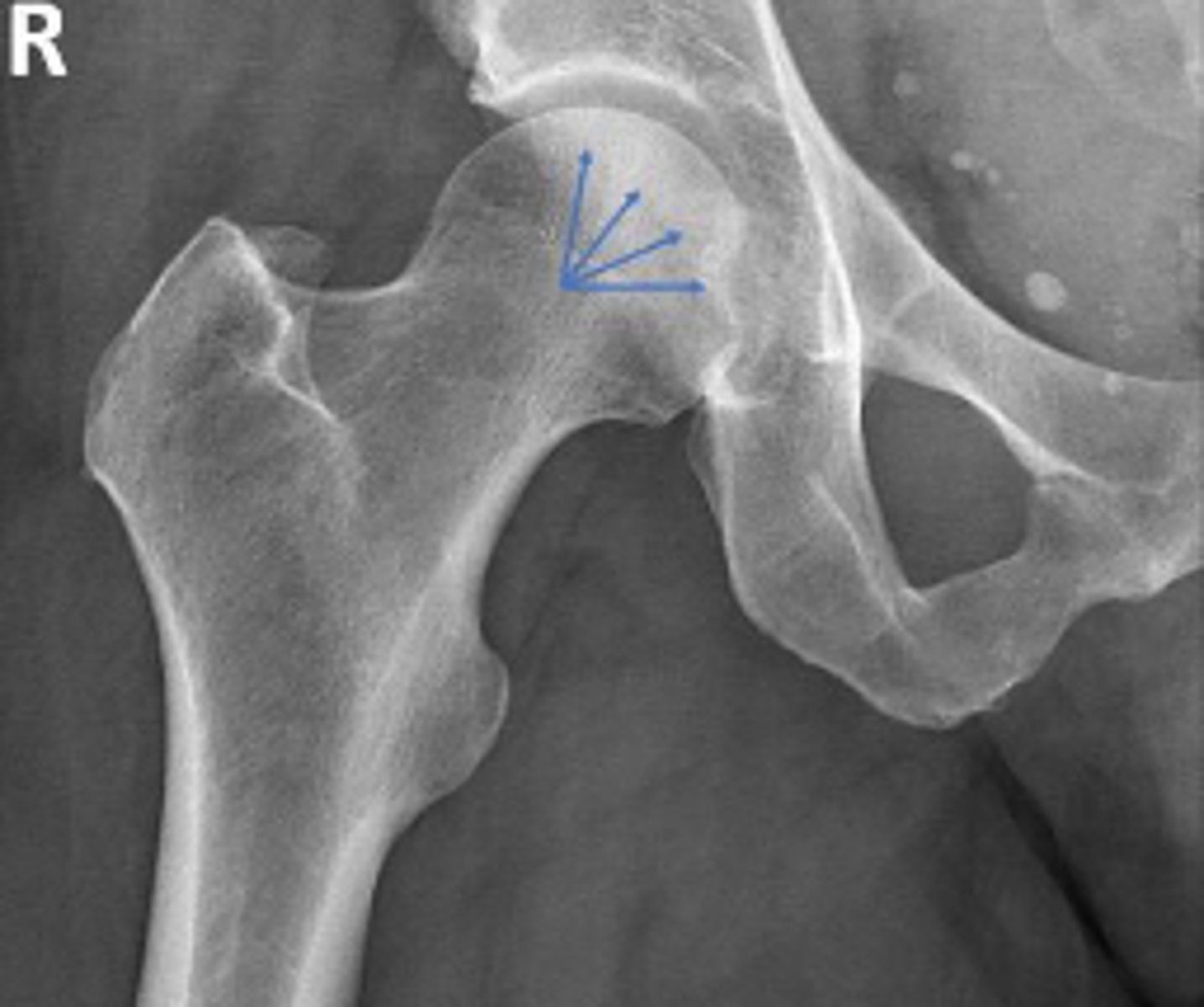 <p>What are the arrows pointing to?</p>