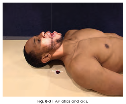 <p>Patient position in the open-mouth AP projection</p>