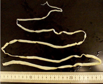 <p>Platyhelminthes: Cestoidea Overview</p>