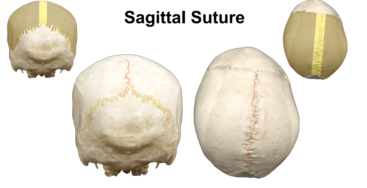 <p>Unites parietal bones in midline</p>