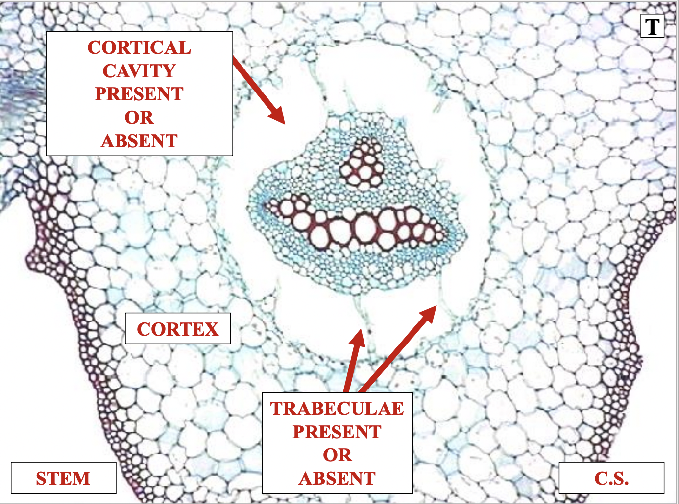 
1. cortex
2. cortical cavity present OR absent
3. trabeculae present OR absent