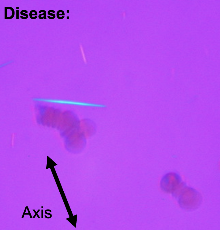 <p>What disease and how can you tell?</p>