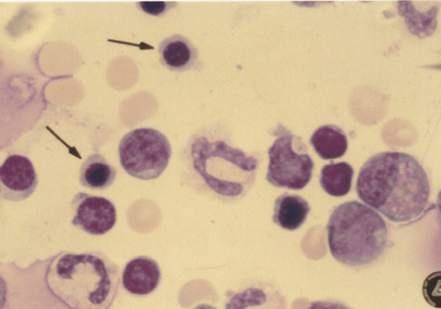 <p>Identify the cells in this body fluid</p>