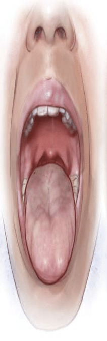 <p><span style="color: rgb(0, 0, 0)">Mallampati 3 score</span></p>