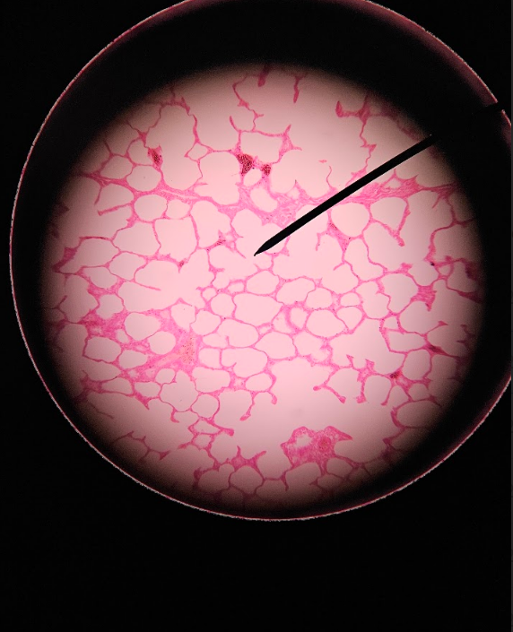 <p>simple squamous epithelium </p><ul><li><p>thin layer of epidermis (one singular layer) </p></li><li><p>has “holes” of empty space </p></li></ul><p></p>