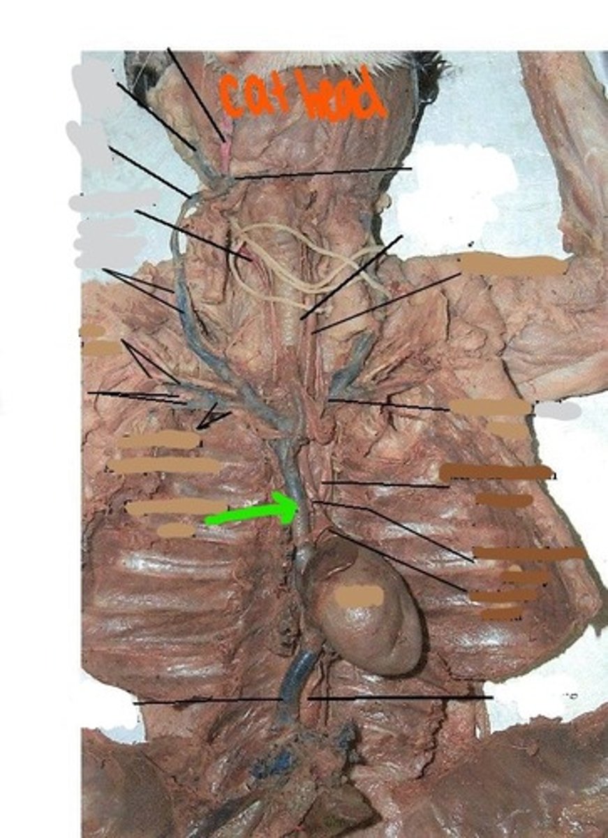 <p>identify this vein</p>