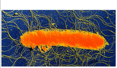 <p>flagella found at multiple locations </p>