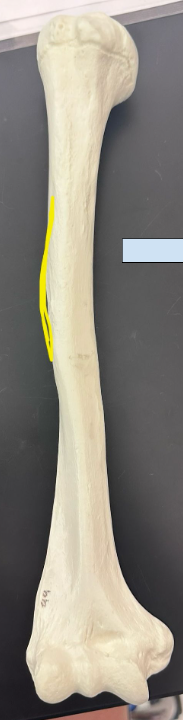 <p>What is outlined in yellow?</p>