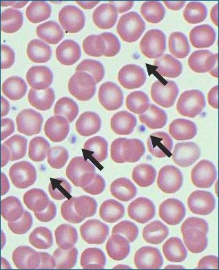 <p>Round/spindle shaped fragments of cytoplasm with no nucleus </p>