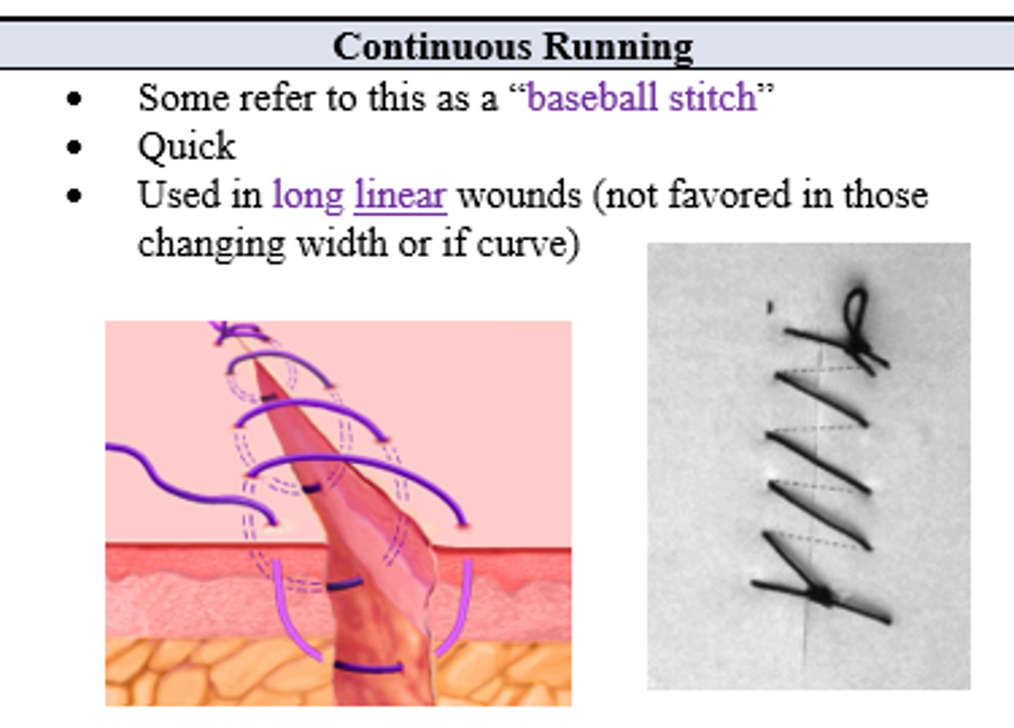 <p>Continuous running</p>