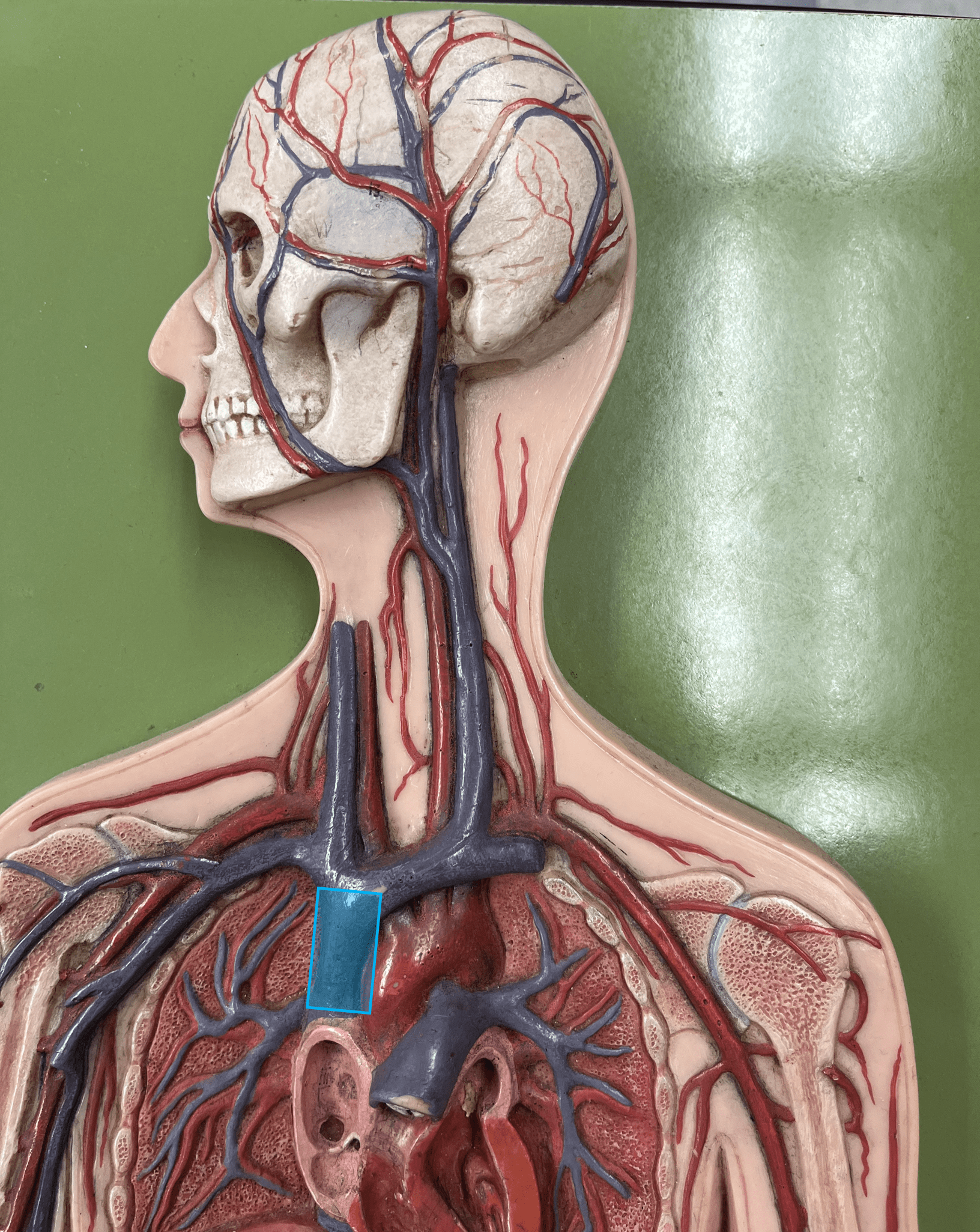 <p>• A vein of the thorax.</p>
<p>• Drains the azygos and brachiocephalic veins.</p>
<p>• Empties into the right atrium.</p>