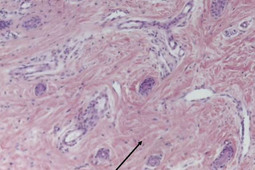 <ol><li><p><strong>Name the tissue type</strong></p></li><li><p><strong>Know where it is found in the body</strong></p></li><li><p><strong>Know its structure</strong></p></li></ol><p></p>
