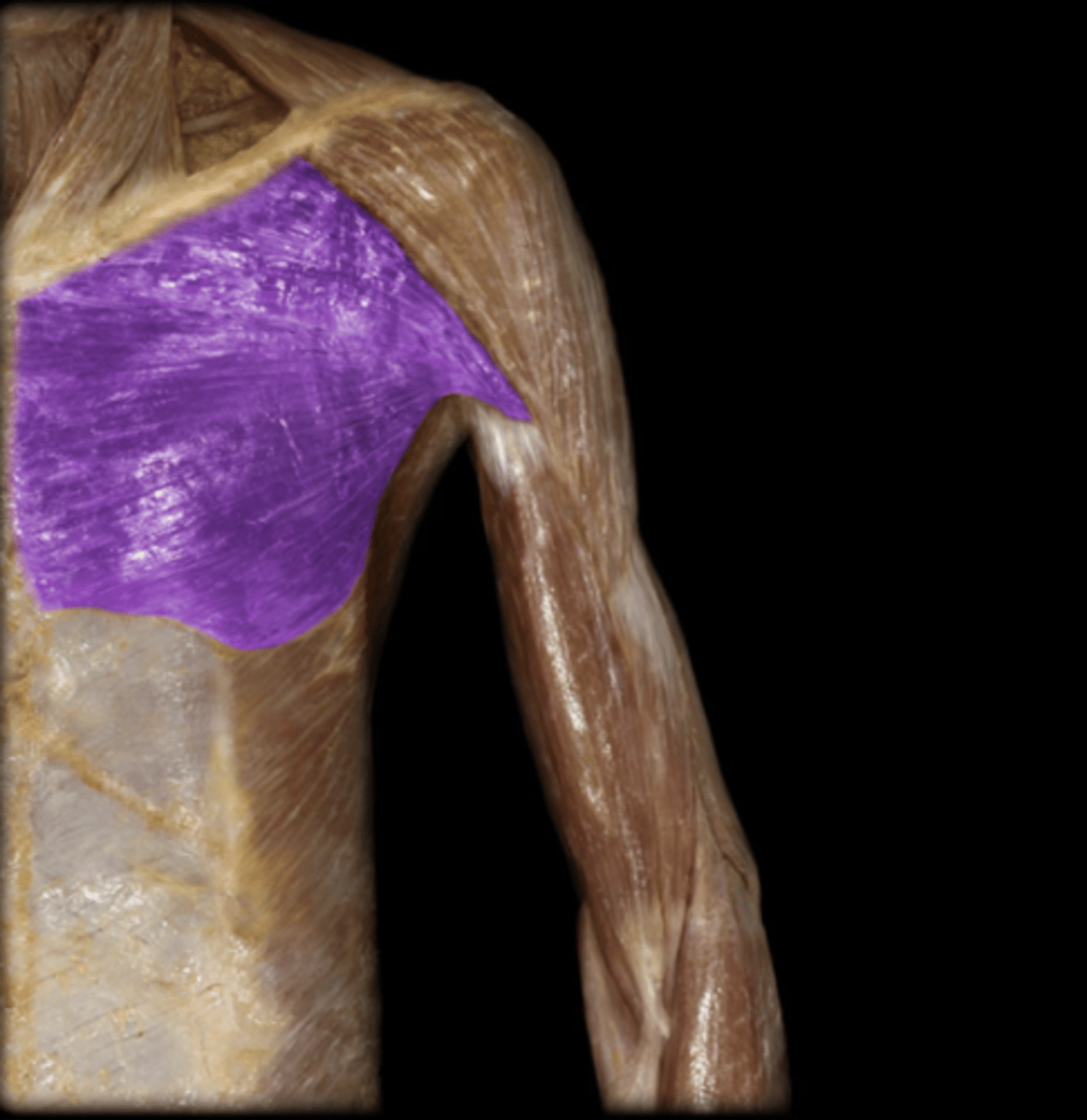 <p>What is this muscle, and what is its action, Proximal &amp; Distal insertions?</p>