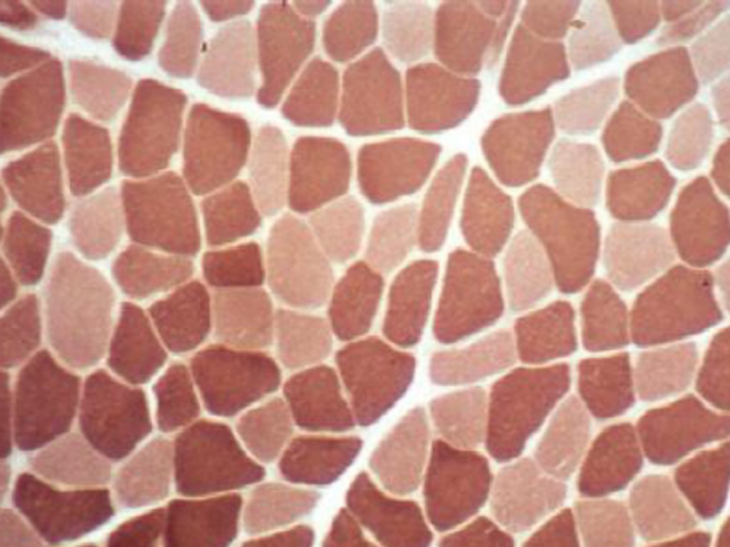 <p>What are type 1 skeletal muscle Fibers?</p>