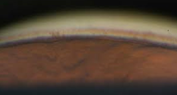 <p>what is the most posterior structure in this image</p>