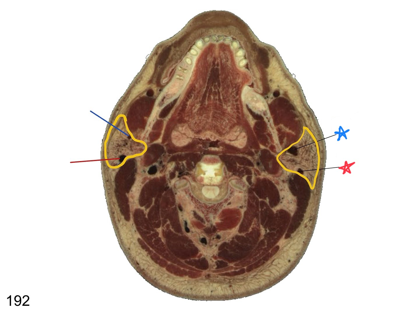 <p>what structure is circled in yellow?</p>