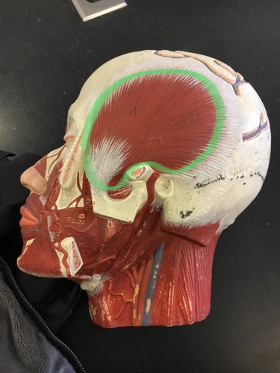 <p>Deep side, where temporal bone is.</p><p>Origin: Temporal Bone </p><p>Insertion: Coronoid Process of Mandible</p>