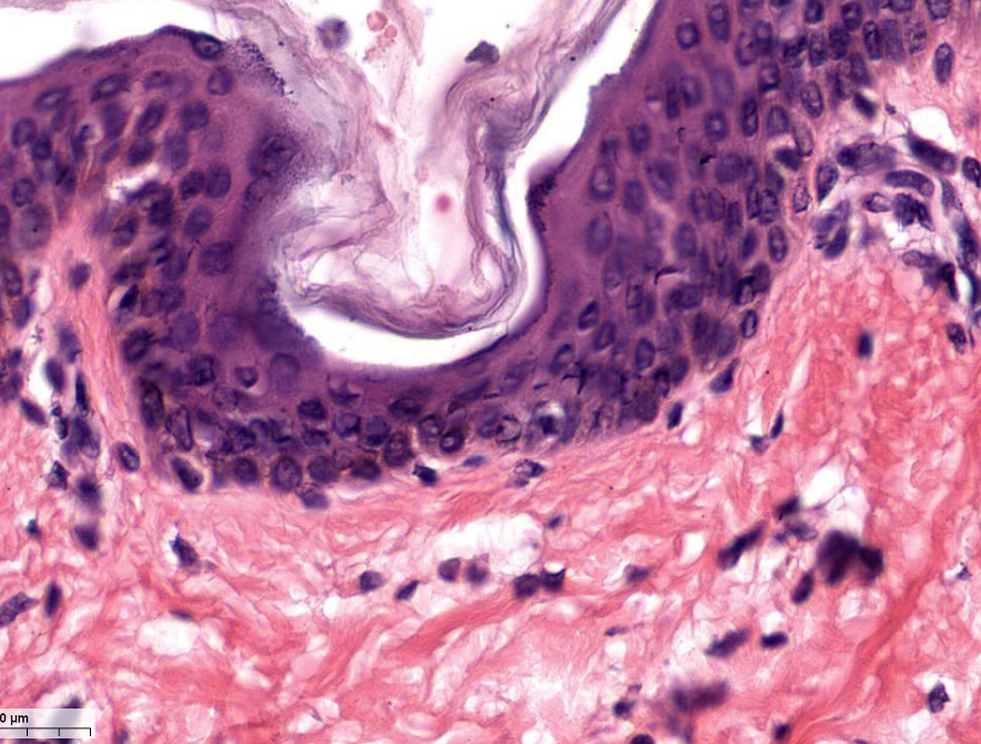 <p>Identify the epithelium and connective tissue of the skin</p>